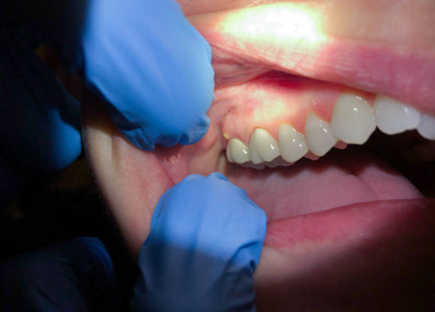 Best Same-Day Emergency Dental Services in Forest Hills, TN