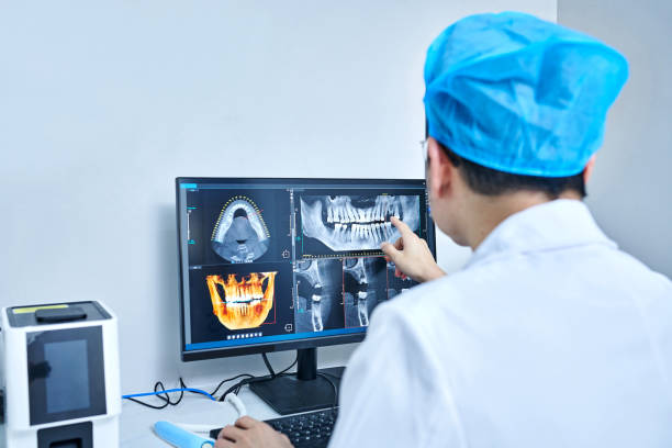 Best Emergency Wisdom Teeth Removal in Forest Hills, TN